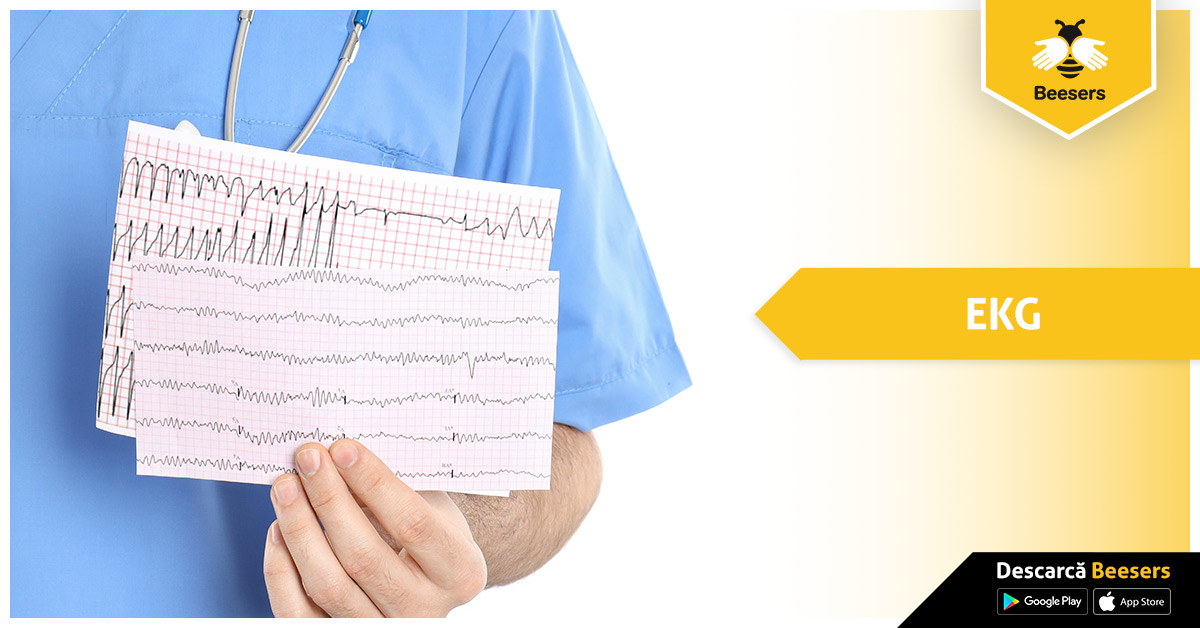 Problemele cardiace: factori de risc pe care îi putem controla